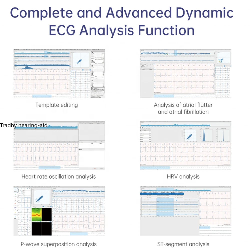 12 Lead 78 Hour Holter ECG EKG Monitor HRV Heart Health Monitor Detects Afib And Irregular Arrhythmias AI-ECG Tracker Analysis