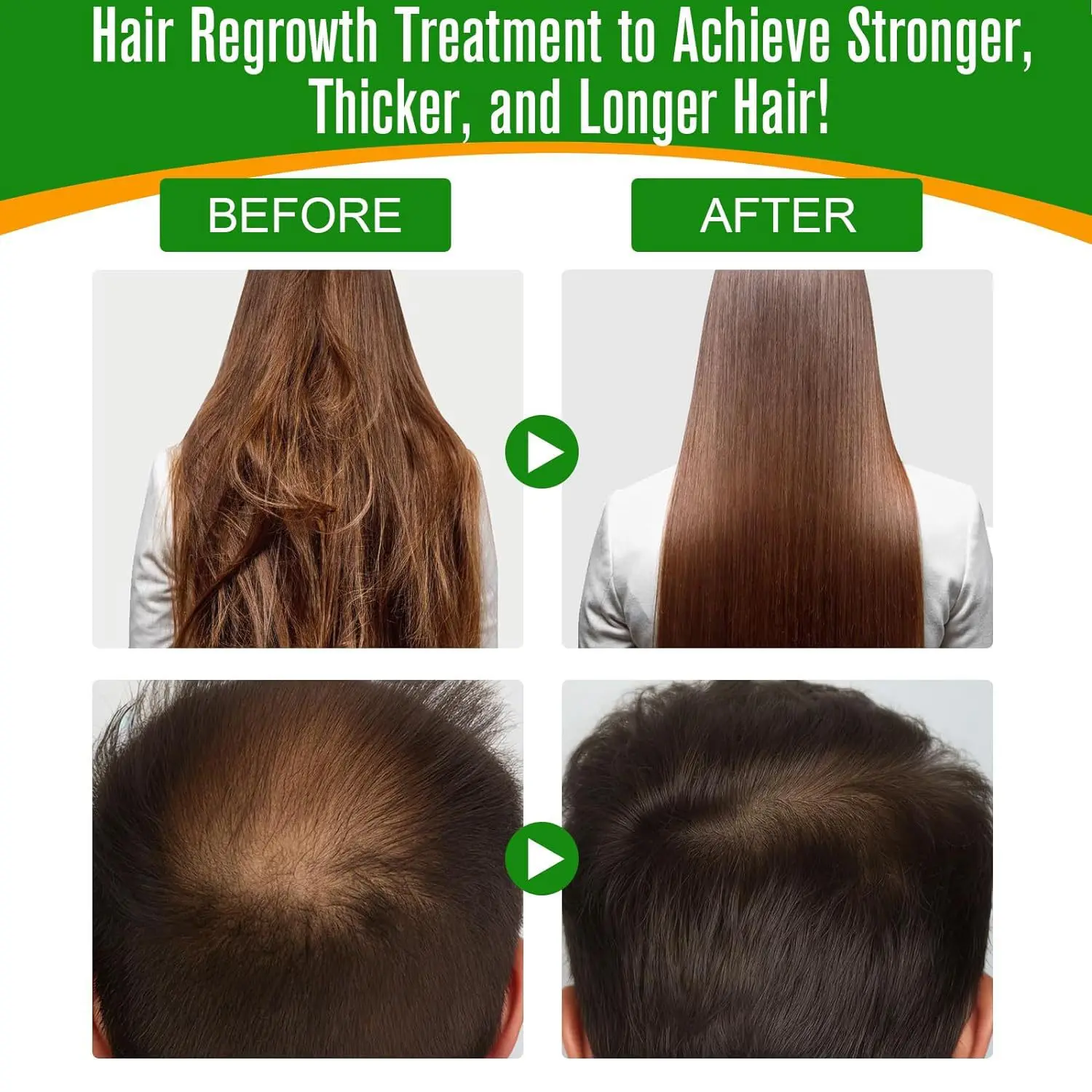 زيت باتانا زيت أساسي متطور لنمو الشعر العناية بالبشرة يحفز نمو الشعر يرطب فروة الرأس Aceite Para El Cabello