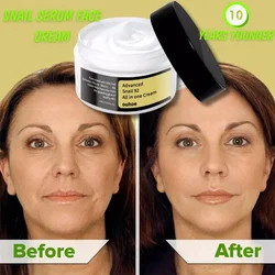 Collagen Anti-wrinkle Facial Cream Acne Melasma Treatment Pigmentation Whitening Face Lifting Beauty Moisturizer Korean Cosmetic