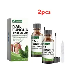 2pcs Onychomycosis Hand Foot Removal Repair Care Nail Fungal Treatment Serum Anti Infection Toe Fungus Paronychia 50g