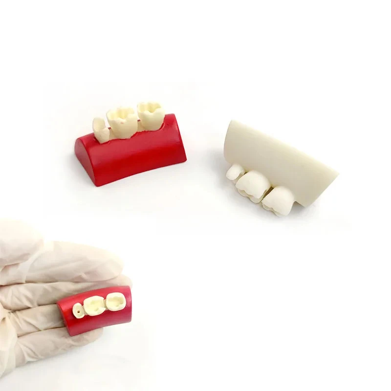 

10 Pcs Dental Resin Block Filling Exercise Inlay Exercise Model Red White Dentistry Materials Tool