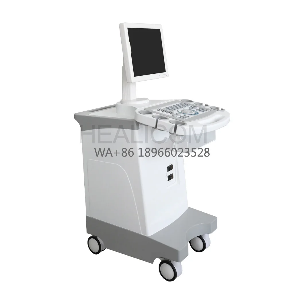 Sistema de Diagnóstico por Ultrasonido para Urología, Carro Médico Completamente Digital de 15 Pulgadas en Blanco y Negro para Obstetricia y Ginecología