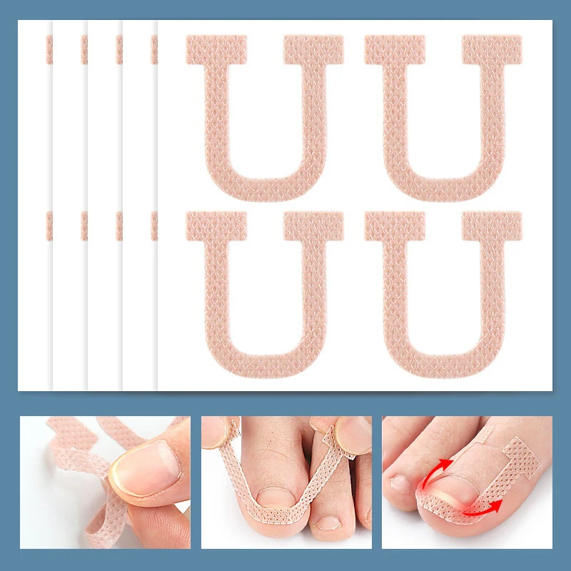 Patch Adhésif pour Ongles Incarnés, Autocollant artificiel astique de Traitement des Ongles, Outils de Soins des Pieds, 4 Pièces/Feuille