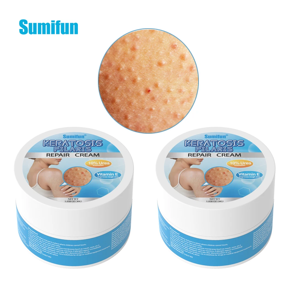 

30g Sumifun Moisturizer Cream Goosebumps Exfoliating Balm Whole Body Whitening Skin Care Soften Horny Relief Acne Mite Itching