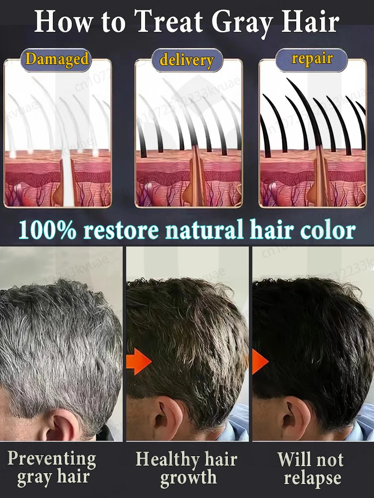 Extraits anti-blanchiment naturels purs pour se débarrasser des cheveux gris et les transformer en cheveux noirs dès la racine