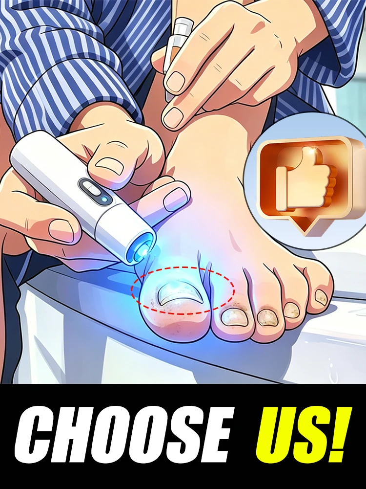 

Generation-2,free shipping,Blue light pen Pedicure Cleaning nail plastic foot tools,Easy and comfortable,Unisex