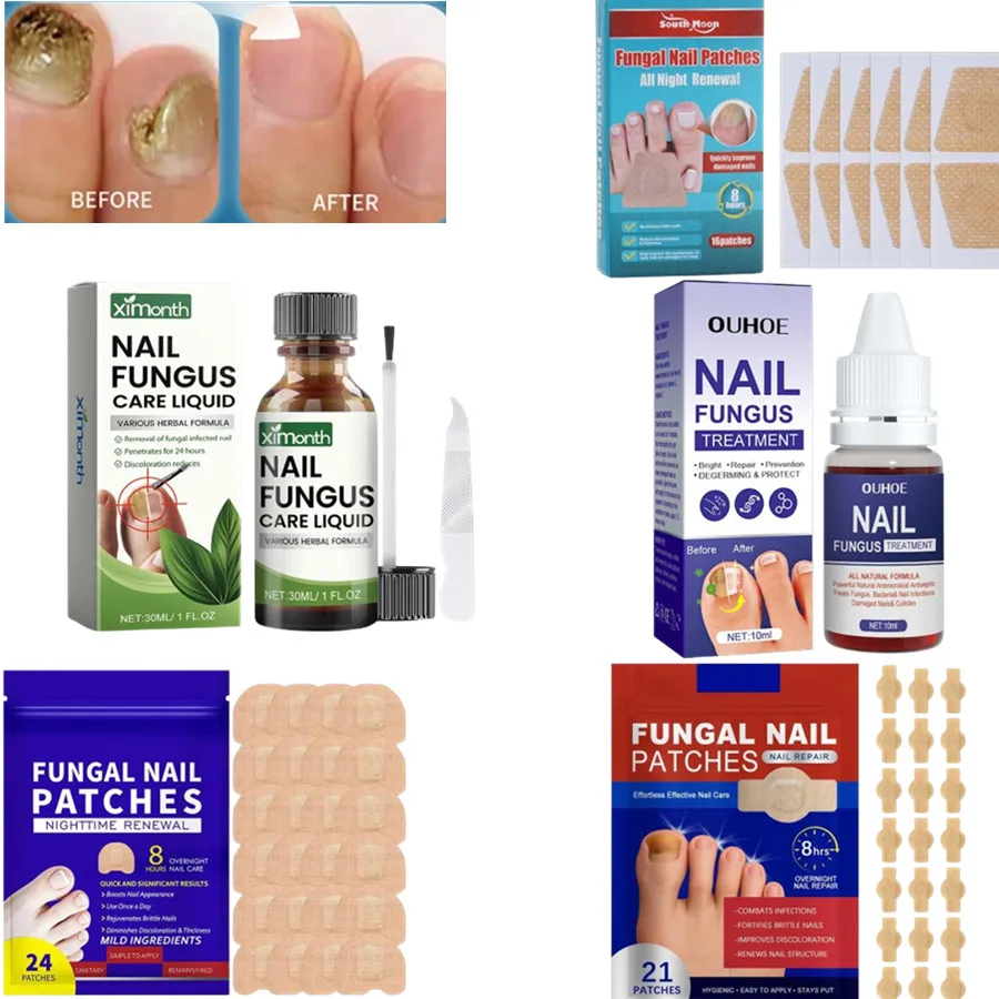 New Bags Toenail Fungus Patch Nail Repair Patches Nail Ingrown Correction Sticker Discolored Damaged Nails Foot Care Tool