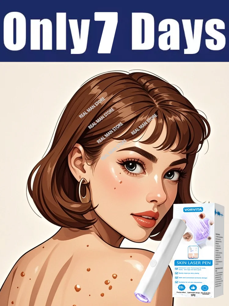 

Модернизированные бородавки 2-го поколения , ремонт корня бородавок 6