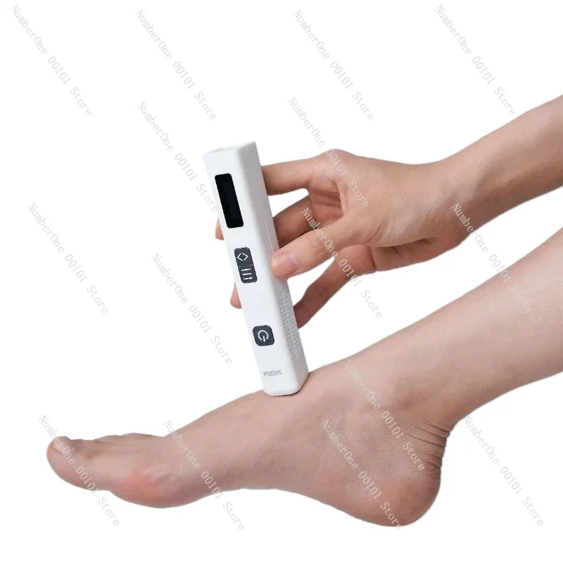 Excimer Laser 308nm Psoriasis Vitiligo Laser Machine for Vitiligo Treatment