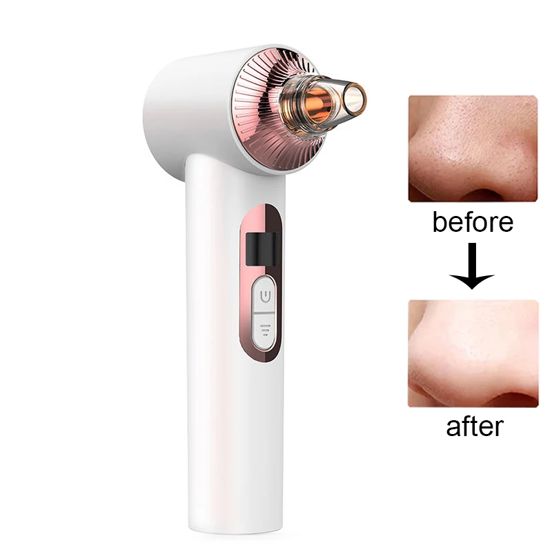 Beauty Products Facial Pore Suction Vacuum Acne Black Head Remover Dropshipping Acne Pimples Remove