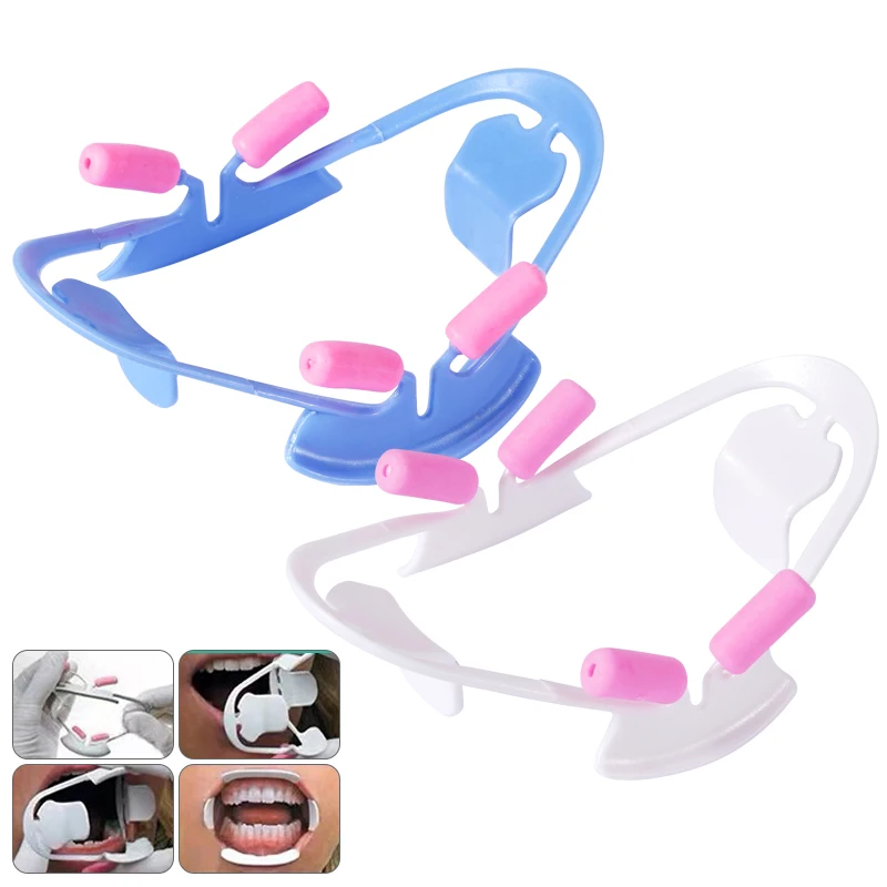 1pc 3D Wang Retractor Tanden Whitening Mond Opener Tandheelkundige Mond Strooier Lip Vorm Opener Tandarts Orthodontische Gereedschappen Blauw Wit - afbeelding 2