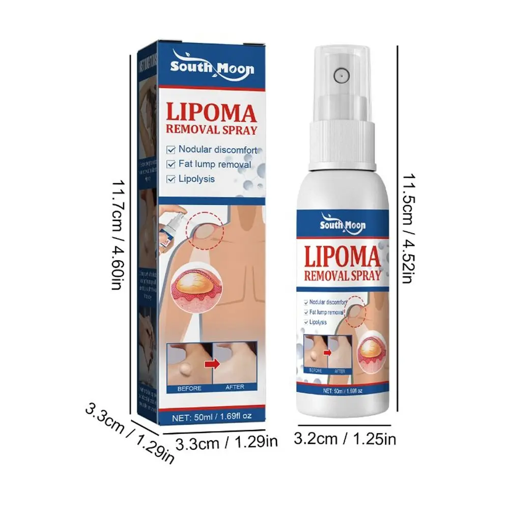 50ml New Relieve Treatment Instant LumpFree Lipoma Lipoma Removal Spray Lipomheilung Reduction Spray