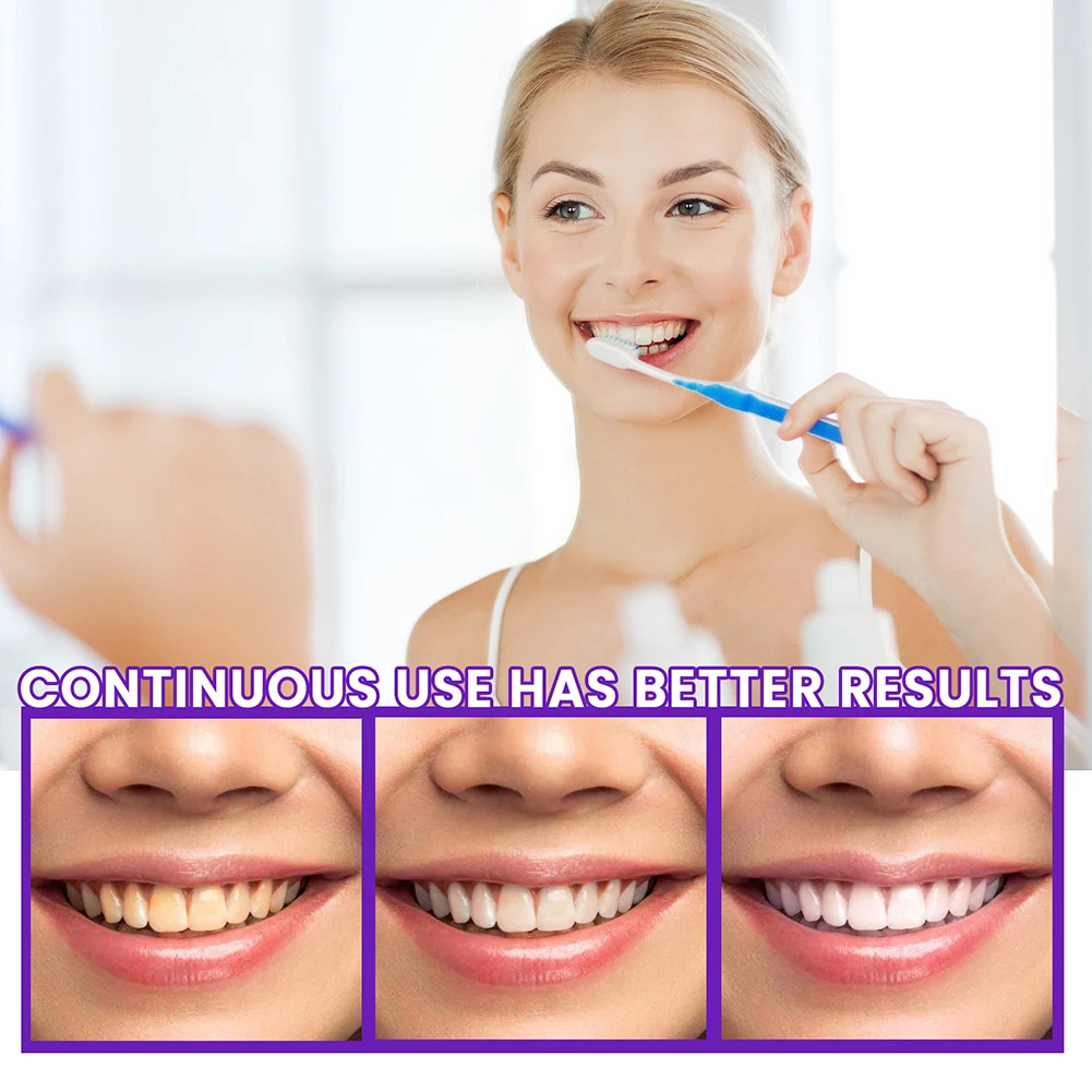 Mild Stains Remove Foam Toothpaste Professional Oral Care Supplies Oral Care Product