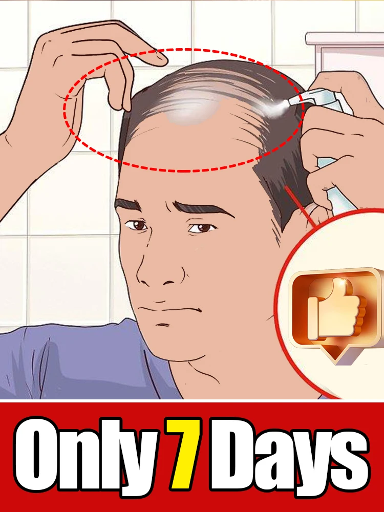 

Праздничные акции 2026 года, M-образная форма, для решения проблем с недостаточной толщиной верхней части, Горячая распродажа