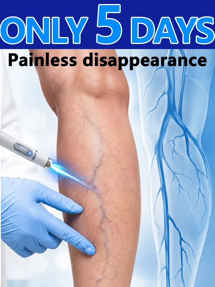 Practical tools for treating venous abnormalities