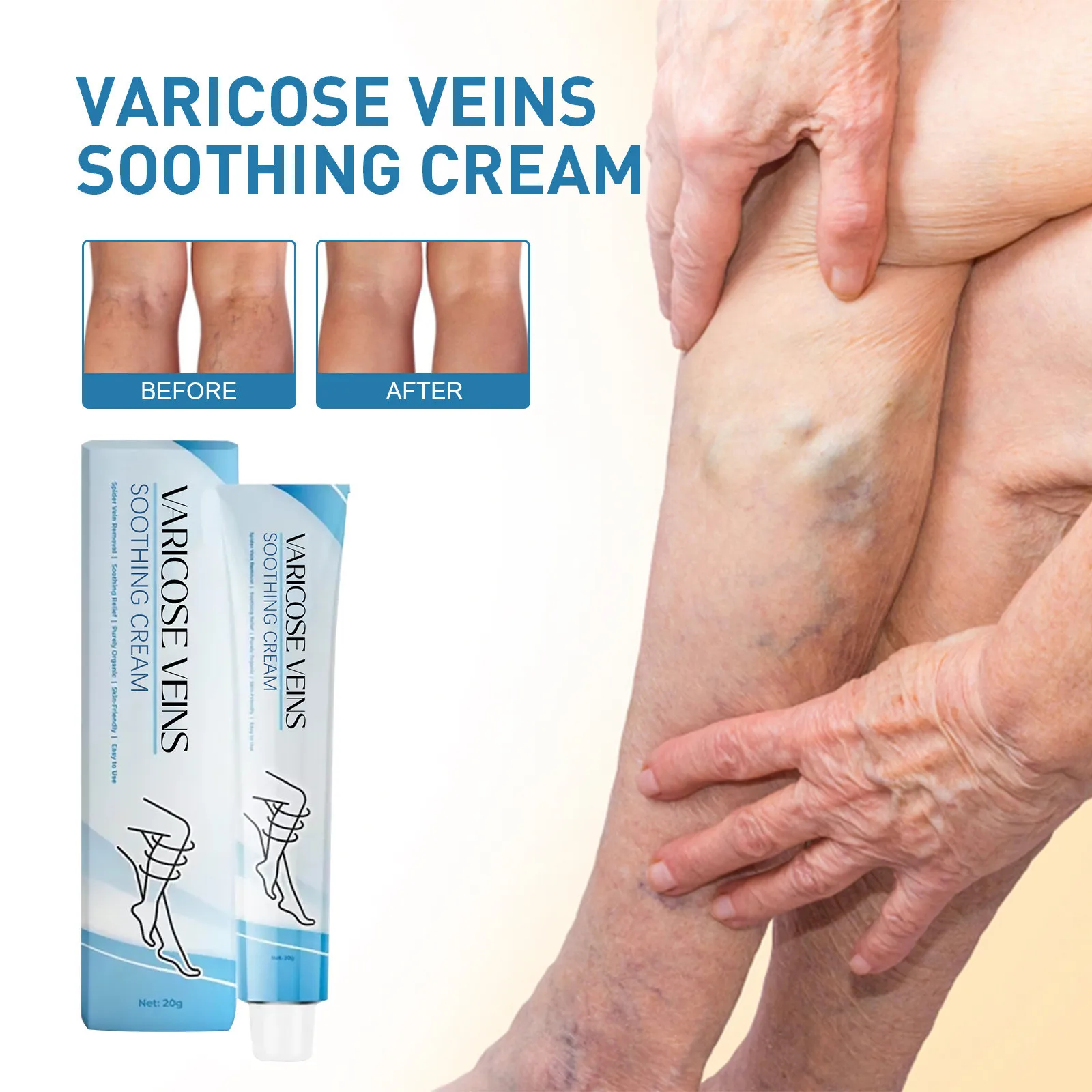 Varicose Vein Ease Paste Varicose Vein Treatment Effective Relieve Legs Dilated Vasculitis Phlebitis Improve Blood Circulation