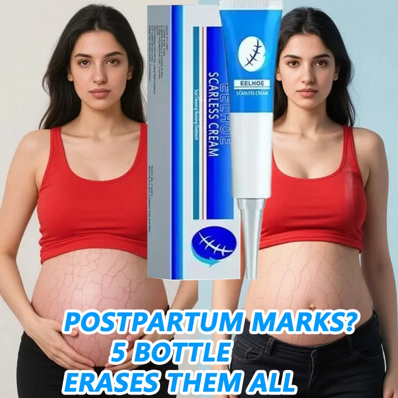

Stretch Mark Cream Hydrates and moisturizes deeply Anti-wrinkle Anti-aging Maternal Skin Repair Remove Pregnancy Body Skin Care