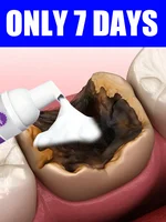 [2025 NEW3.0] Herramientas para el cuidado de limpieza de dientes, espuma oral, envío gratis