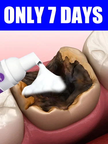 [2025 NEW3.0] Herramientas para el cuidado de limpieza de dientes, espuma oral, envío gratis