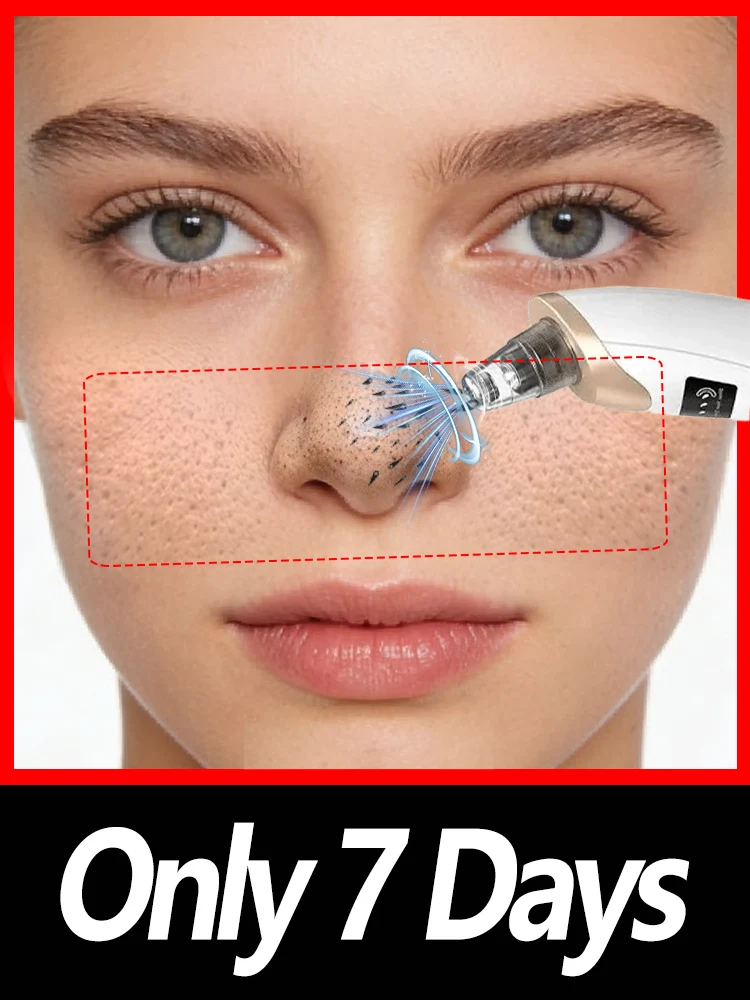 

2026Upgrade Electric Blackhead Remover Vacuum Cleaner Facial Deep Cleansing Pore Cleaner for Black Spots and acne