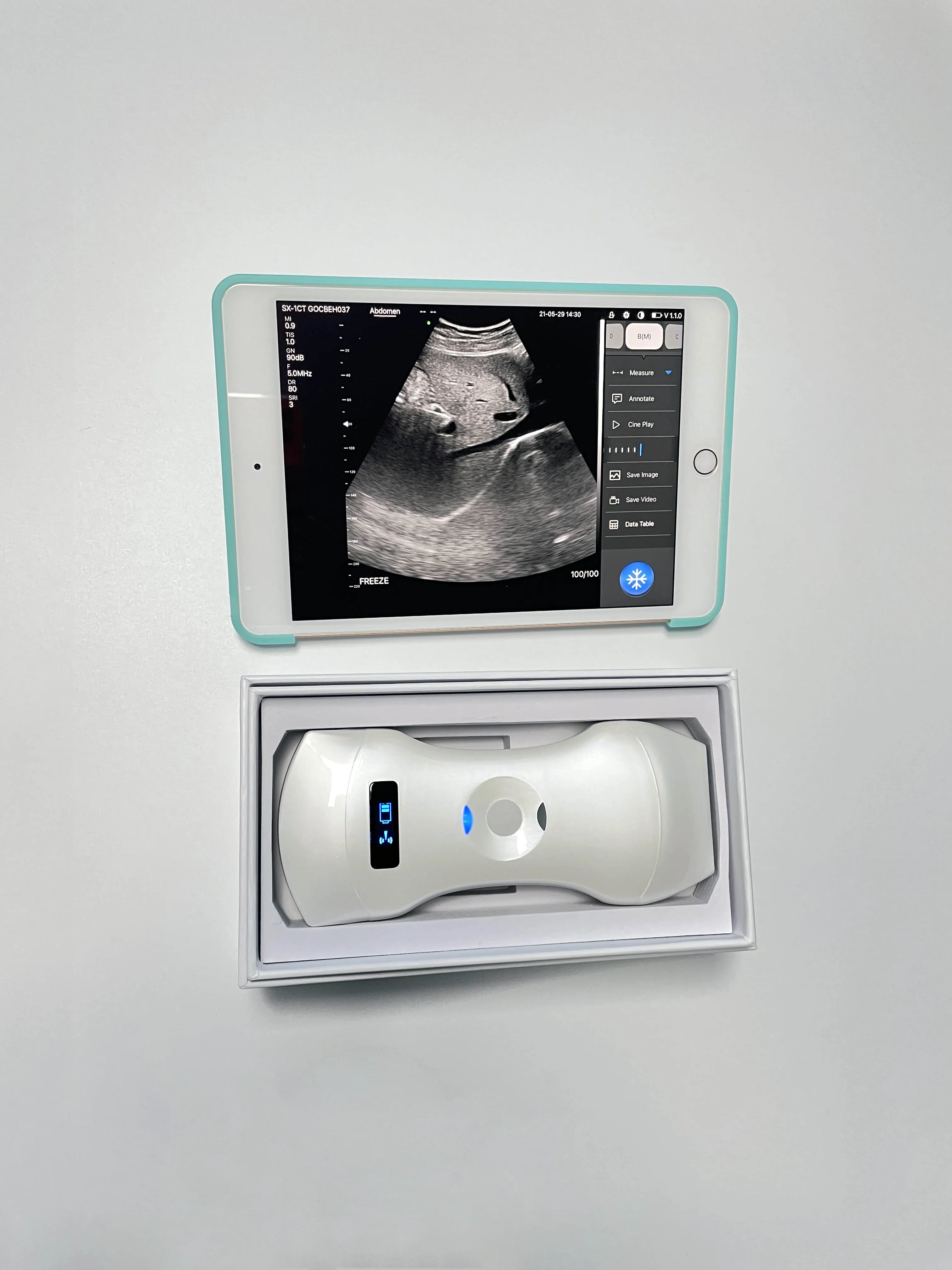 Handheld Drinkbaar Phased Array Cardiale, Lineaire, Transvaginale & Bolle 3 In 1 Kleur Doppler Ultrasound Scanner