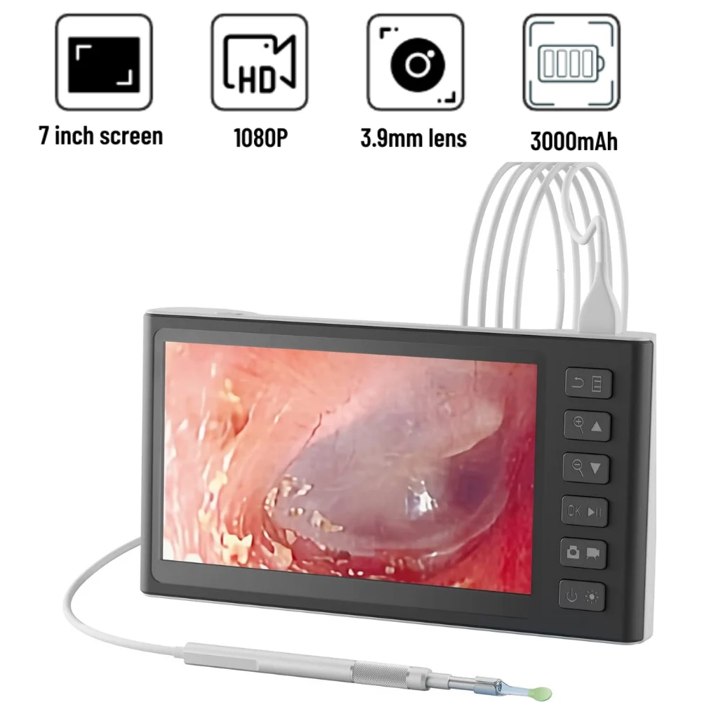 7 inch Screen Digital Otoscope 3.9mm 1080P HD Ear Scope Endoscope Ear Cleaner With 2500mAh Rechargeable Battery 32GB SD