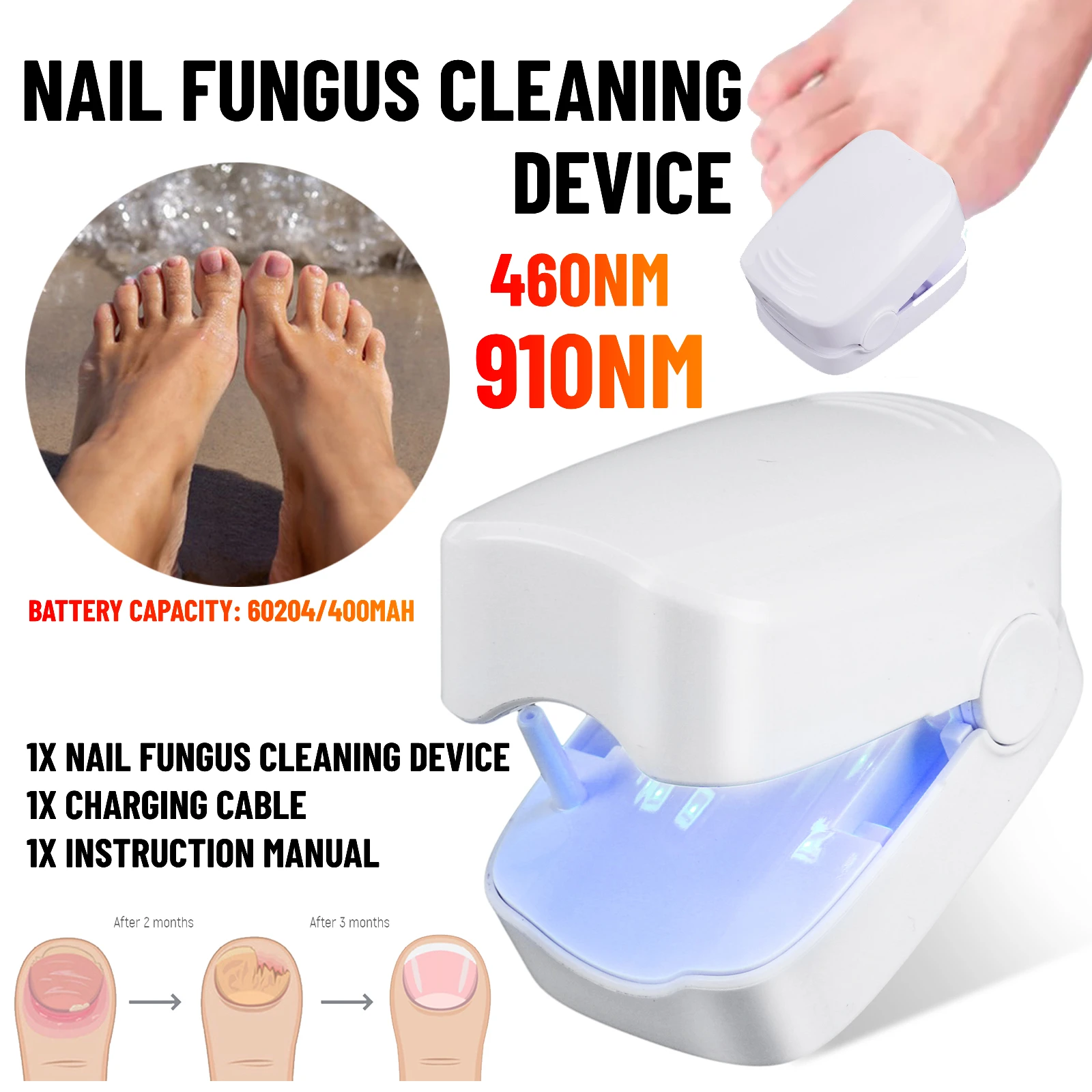 Nail Fungal Laser Repair Device Fast Nails Fungus Onychomycosis Repair Toenail Fingernail Removes Nail Fungus Foot Care Device