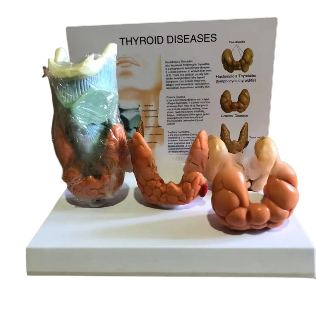 

Supply teaching model, thyroid disease model, anatomical model, medical textbook model