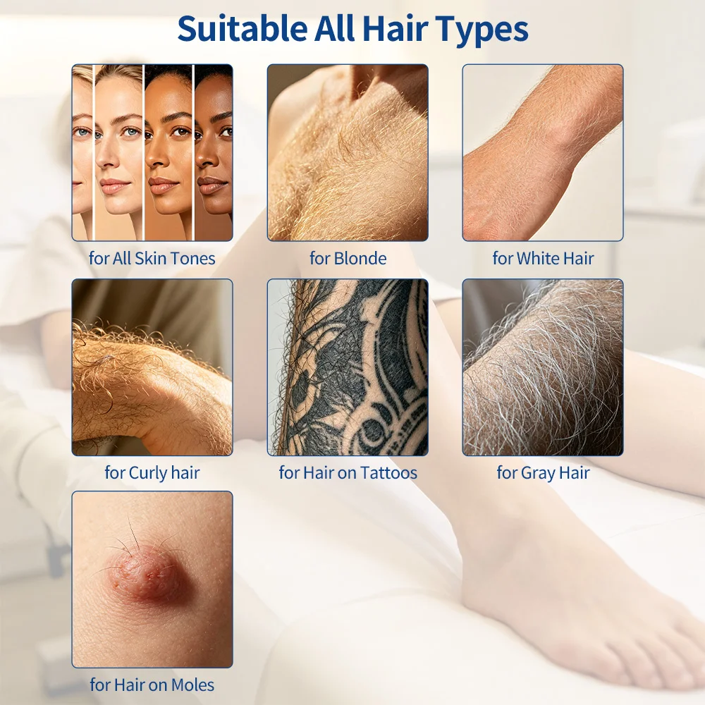 Thumbnail 3 - #8 Best Rated Epilators to Buy in 2026