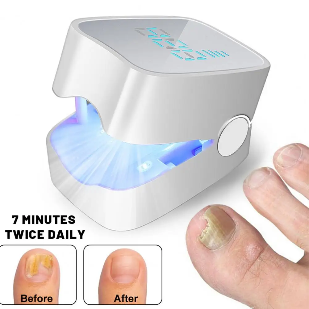 휴대용 네일 치료 램프 910nm 적외선 407nm 청색광 발톱 건강 두꺼운 손상된 손톱을 위한 손발톱 곰팡이 치료