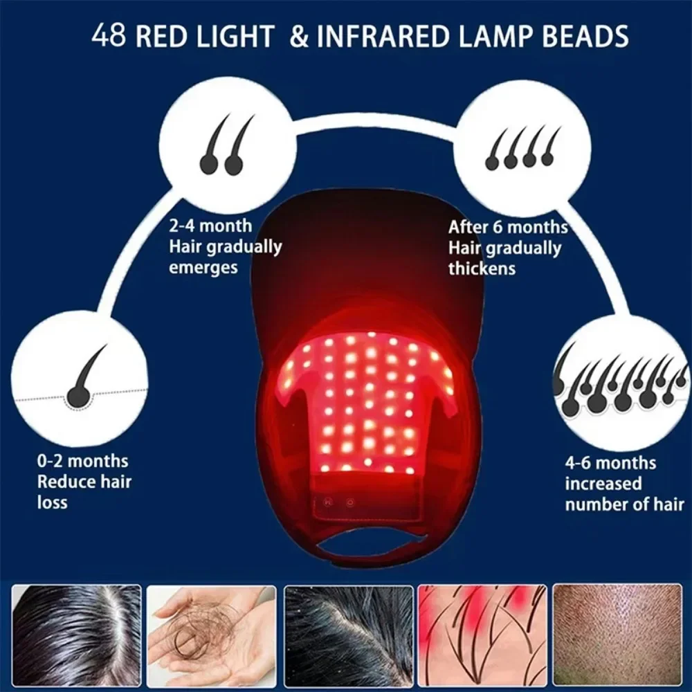 ZONGKUNG Hair Growth LED Red Light Therapy Cap Red & Infrared Light Therapy Hat Device For Hair Loss Treatment With USB Charging