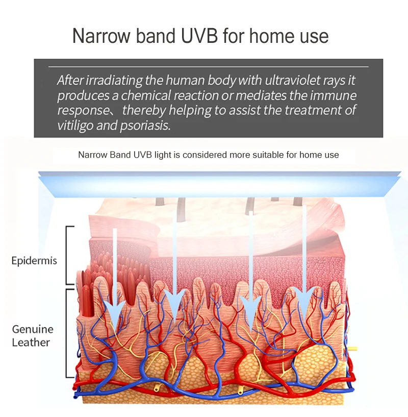 308nm Uvb Vitiligo лампа для лечения псориаза, оборудование для физической терапии, экземы, узкополосные фототерапевтические лампы, медицинский источник