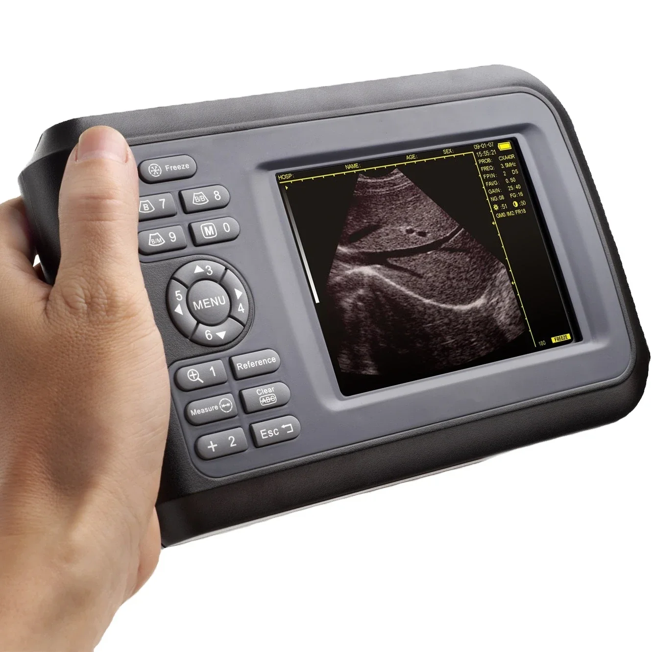 

Portable Vet Diagnostic Medical USG Ultrasound Scanner Pet Bovine Equine Cow Cat Dog Veterinary Ultrasound Machine