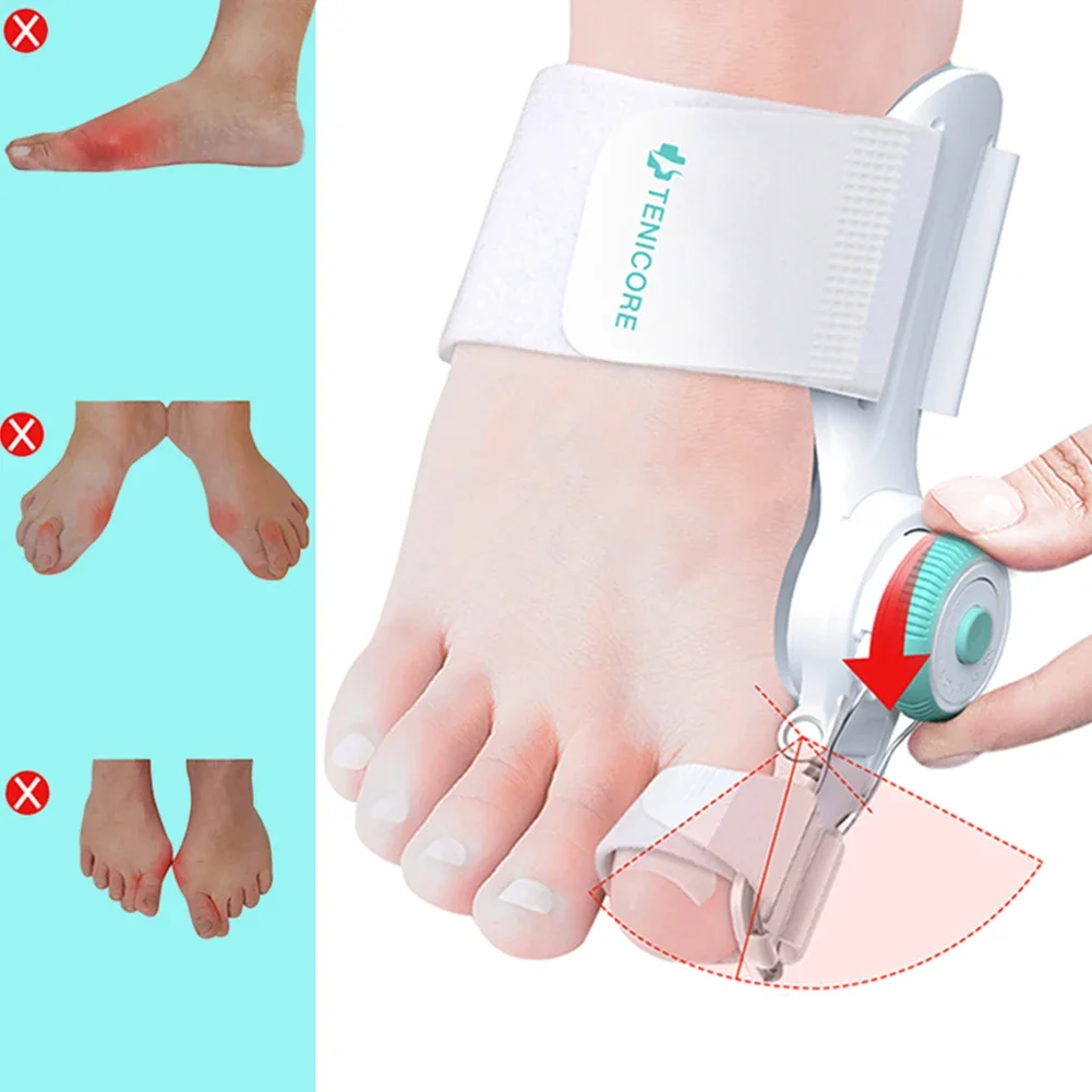 Unisex Thumb Bursitis Splint Relieve Pain with Knob Big Bone Toe Bunion Splint Rotatable Adjustable Daily Wear for Foot Supplies