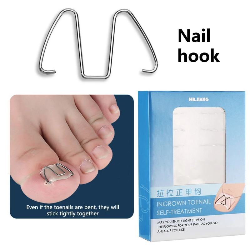 Ingrown Toenail Correction Tool Ingrown Toe Nail Treatment Nail Hook/Steel Wire Straightening Clip Paronychia Pedicure Corrector