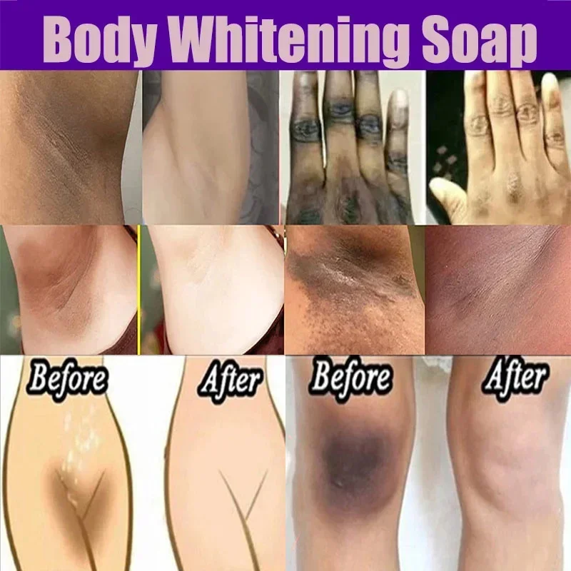 Body Whitening Soap Deep Clean Skin Chicken Skin Removal Soap Bleaching Body Brighten White Care Product Beauty Health Care