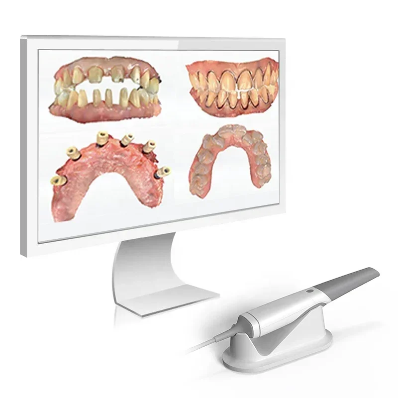 NEW Automatic Anti-fogging Ergonomically Designed Portable Dynamic 3D Intraoral Scanner Shinning For