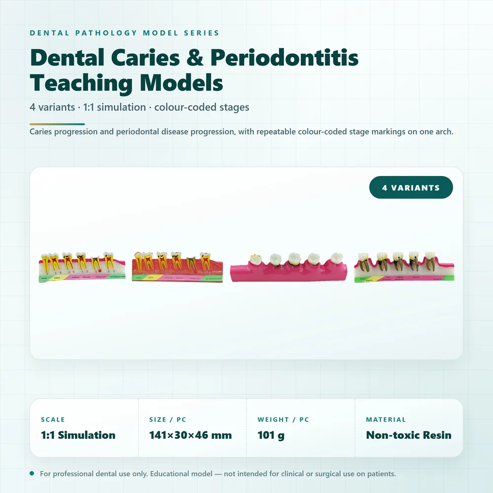 Dental Pathology Model 1:1 Caries and Periodontitis Demonstration Model for Dentist Student Oral Teaching Patient Communication