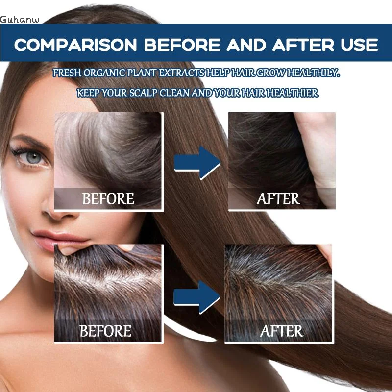 

East Moon Hair Growth Serum Spray Lasting Smoothing Strengthen Roots Powerful Nourishing Regrowth Oil Hair For Men Women