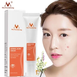 Rosacea Cream Red Nose Ointment Remove Blackhead Acne Cream Skin Care Herbal Anti Acne And Mite Acne Rosacea Treat Shrink Pores