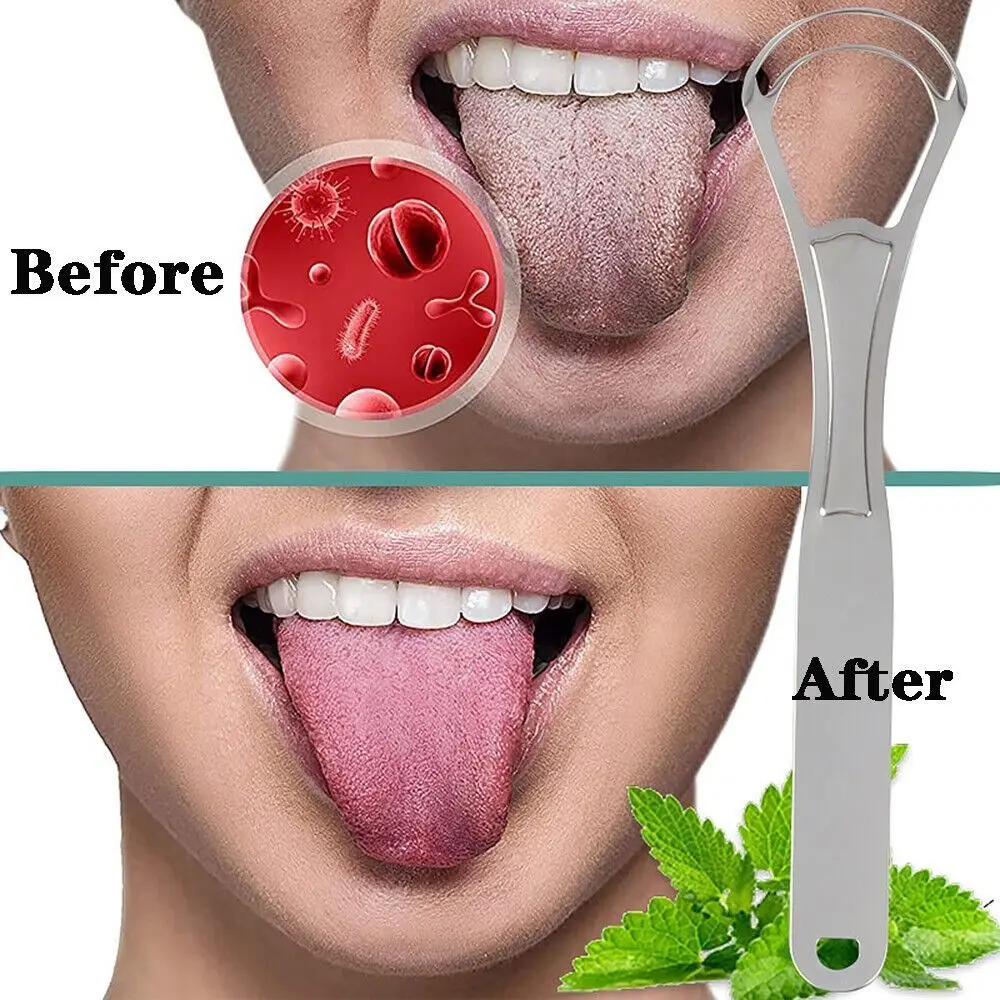 Double Decker Mouth Brush High Quality Clean Tongue Stainless Steel Tongue Cleaner Tongue Brush