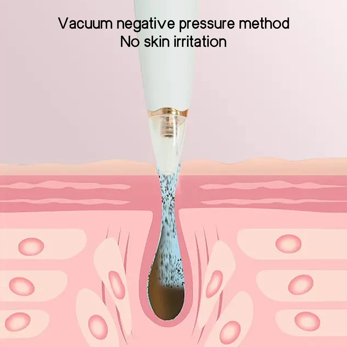 Elektrisches Porenreinigungsgerät zur Entfernung von Mitessern, Vakuum-Akne-Behandlung, kompakt und tragbar, ein unverzichtbares Hautpflege-Werkzeug