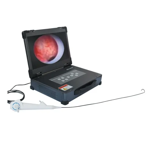 Single-Use Ultrasonic Diagnostic Ureteroscopes with endoscopes Camera for Flexible Surgerys