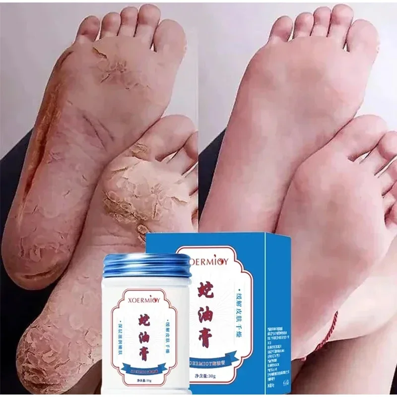 Herbal Anti Crack Foot Cream Heel Cracking Repair Products Exfoliation Dead Skin Removal Softening Moisturize Smooth Skin Care