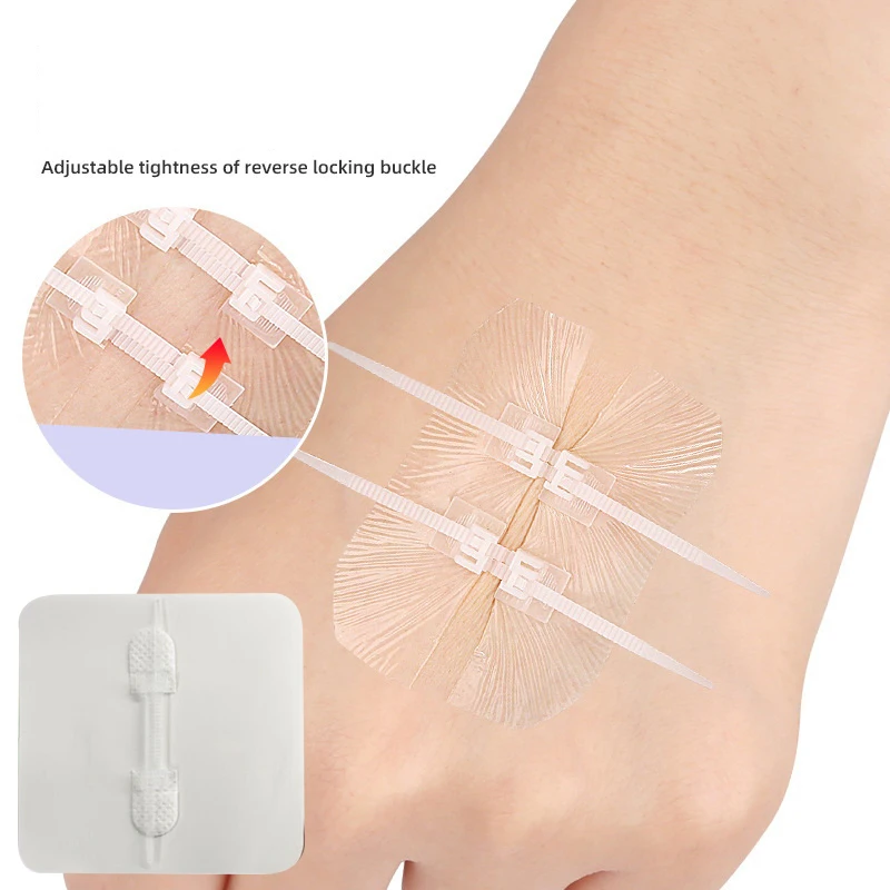 Zipper Band-aid Painless Wound Closure Device Suture-free Wound Dressing Patches Zip Suture Reducer Band Aid