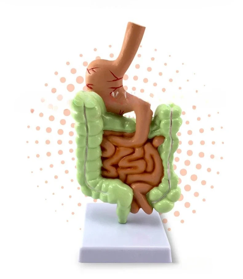 Colorectal pathology model, gastrointestinal model, colorectal lesion model, intestinal disease, human colon lesion model