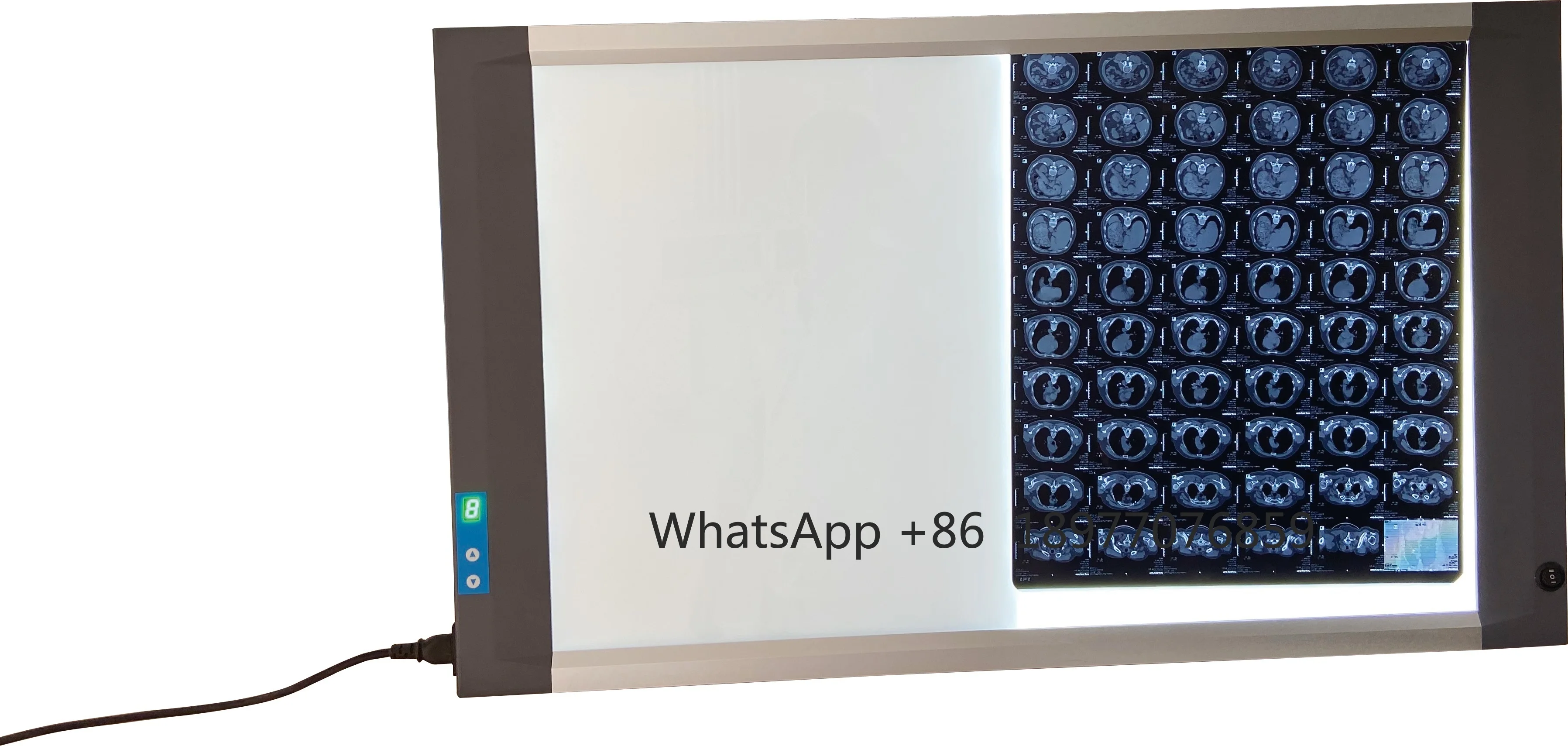 Made With  Screen MST-4000II Double Panels LED X-ray Film Viewer Switch On/off Negatoscope LED