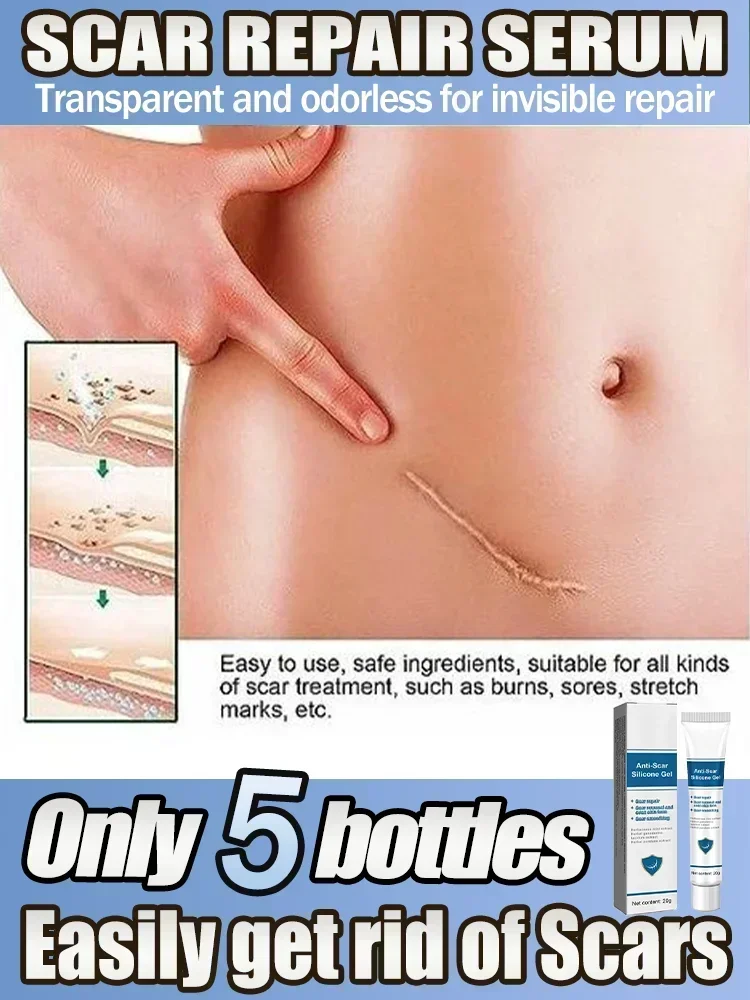 Rapid Scar Healing  Maternity Skin for Keloid and Stretch Mark Treatment Post-Surgery and Burn Care Product1309