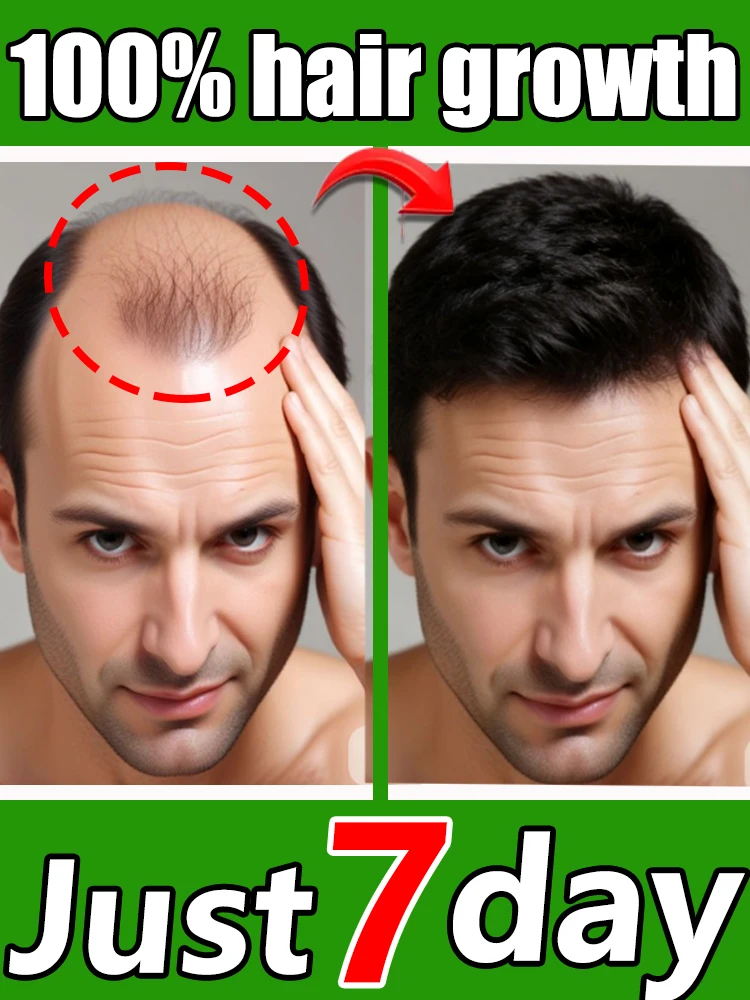 

Hᴇʀʙᴀʟ ғᴏʀᴍᴜʟᴀ,refreshing and ɴᴏɴ-ɢʀᴇᴀsʏ nourishes hair