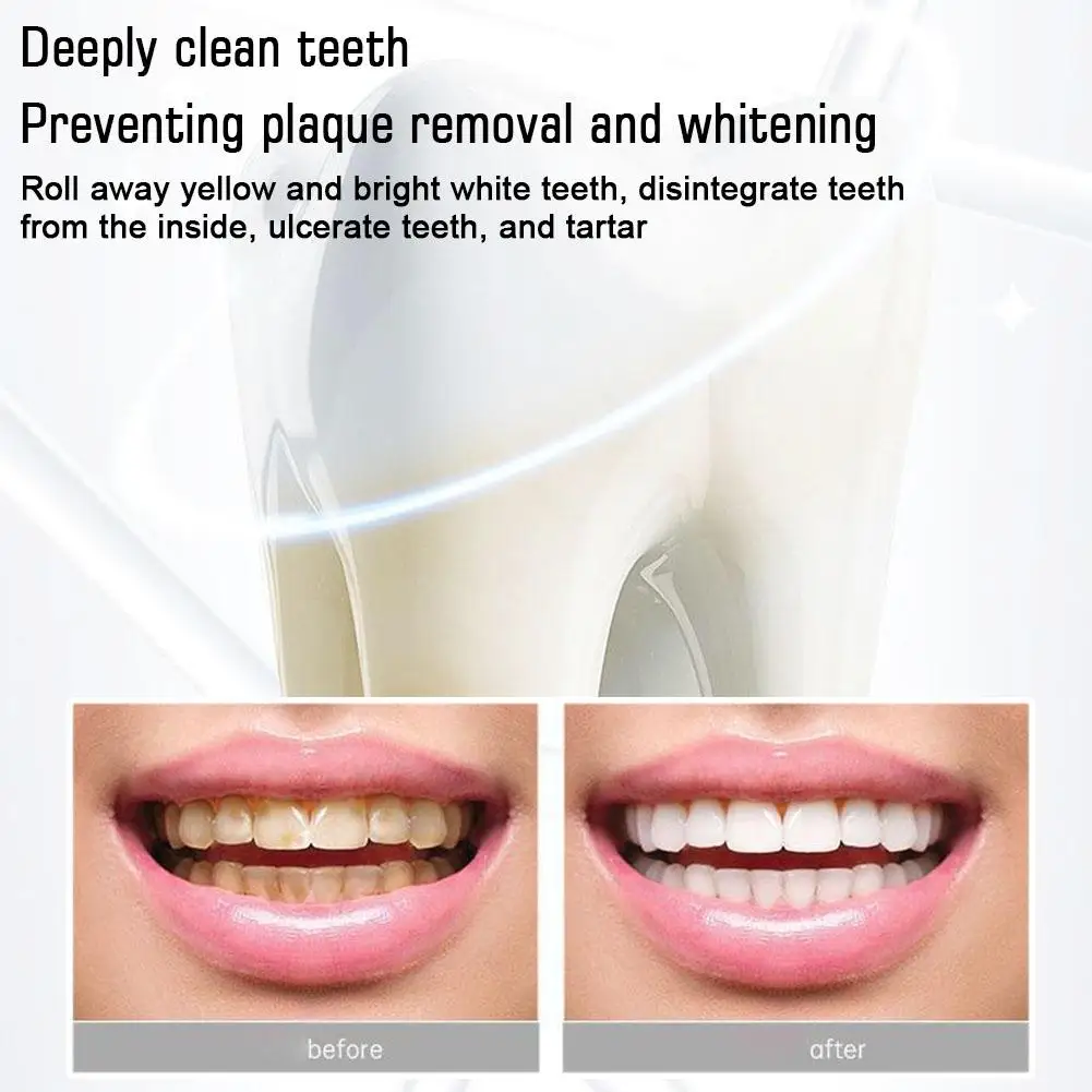 120g SP4 Probiotic Caries Whitening Toothpaste Repair Tooth Decay Paste Cleaner Teeth Remover Plaque Fresh Breath Oral Care